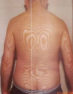 パーキンソン病の検査（治療前）