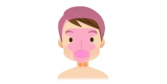 Ａ.記憶・嗅覚・味覚障害を改善する鍼治療の範囲