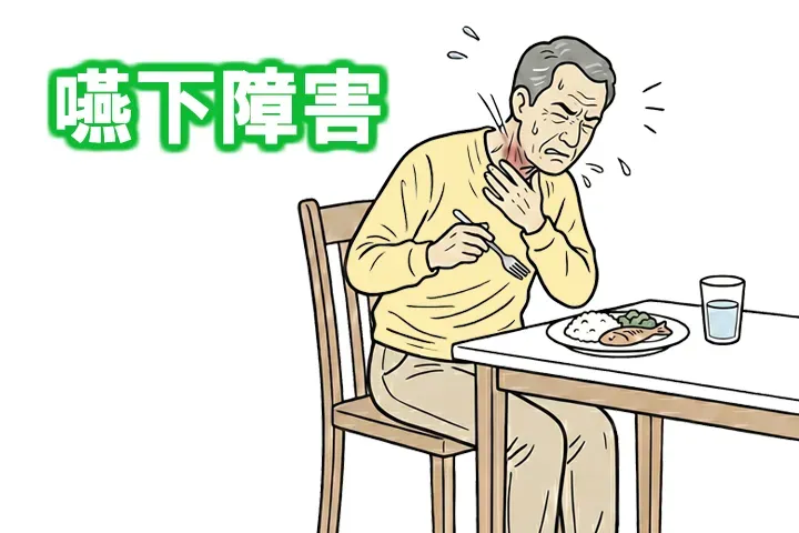 脊髄小脳変性症の患者さんでよく見られる嚥下障害の画像