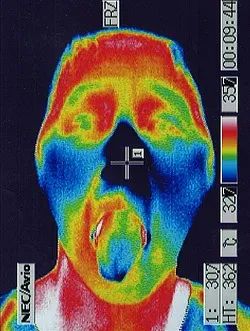 舌と顔の温度｜医療用サーモグラフィ画像