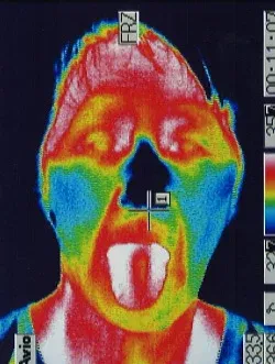 舌と顔の温度｜医療用サーモグラフィ画像