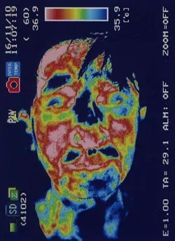 鍼治療前の顔面痙攣