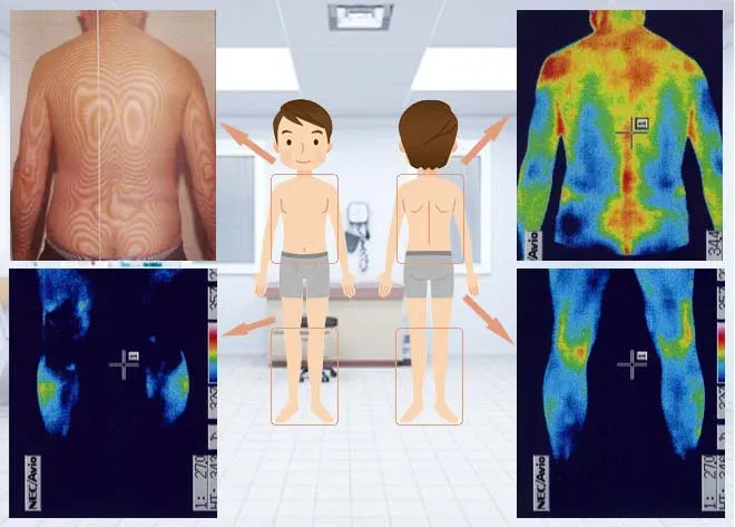 顔面痙攣の原因を調べる検査