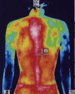 頚椎ヘルニアの原因|手の温度(治療前)