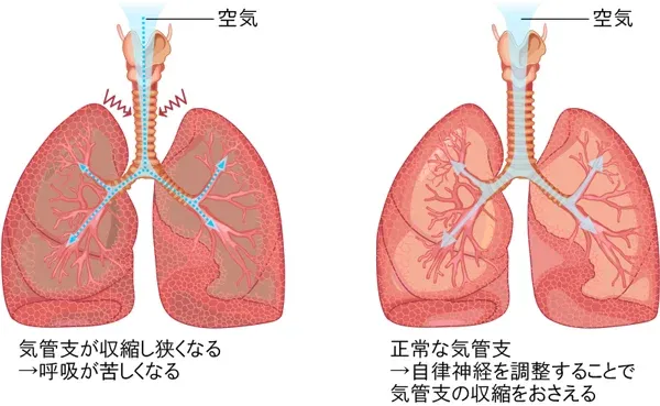 自己免疫疾患