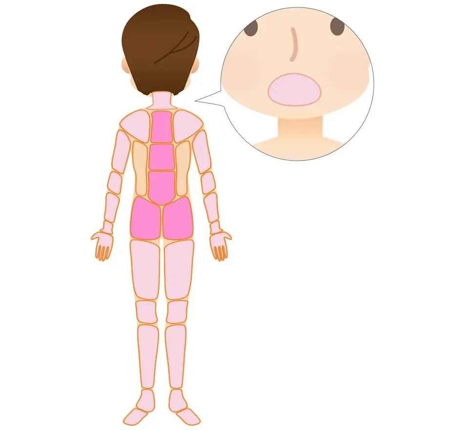 多系統萎縮症の小脳の運動機能を高める鍼治療の範囲