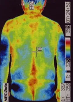 パーキンソン病の検査（治療後）