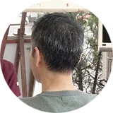 脊髄小脳変性症の鍼灸（東洋医学）の治療を希望されて石川県から通院されているＮさん
