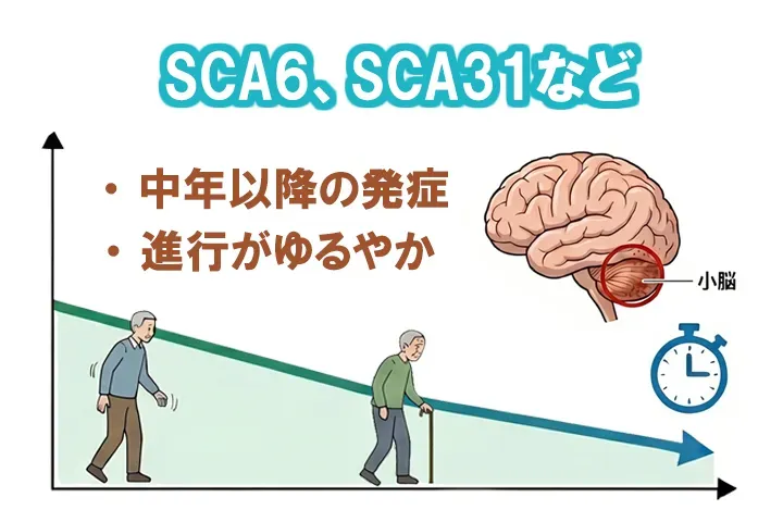 常染色体顕性遺伝の脊髄小脳変性症sca6とsca31の進行を現した画像