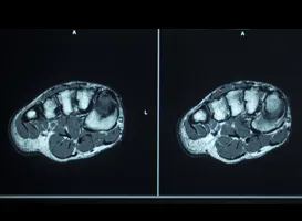 足首の痛みの原因を調べるX線検査