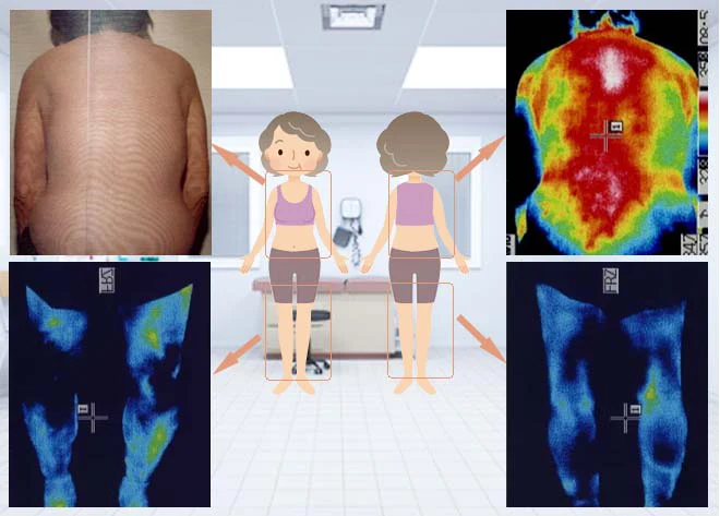 膝痛の原因を探す検査