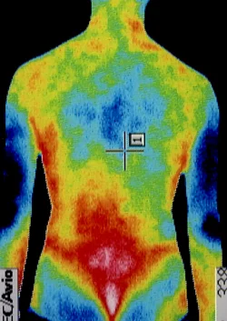 水が溜まる膝の検査｜筋肉の代謝異常を調べます。