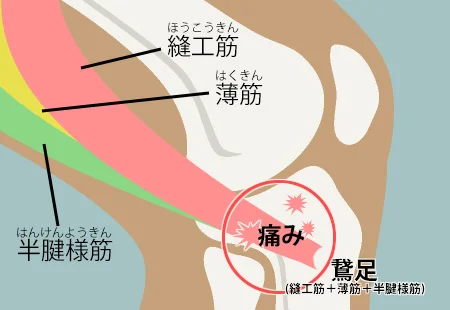 膝の構造と鵞足炎