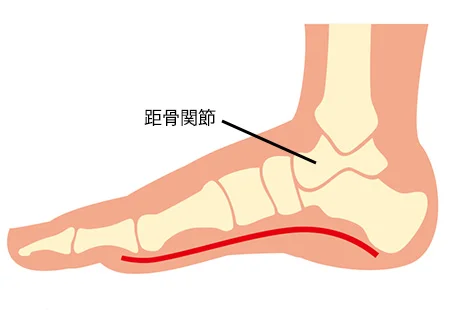 間欠性跛行の鍼治療