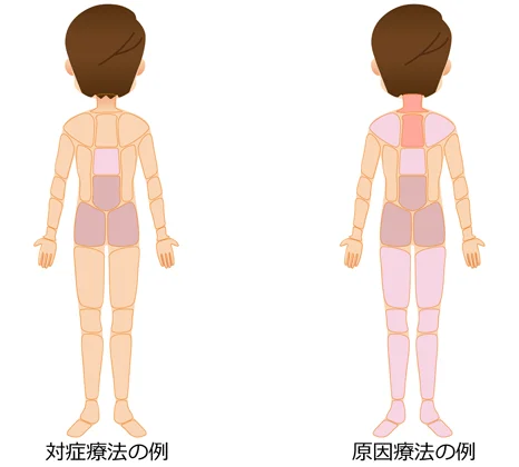 対処療法 原因療法の治療部位