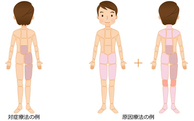 対症療法 原因療法の治療部位