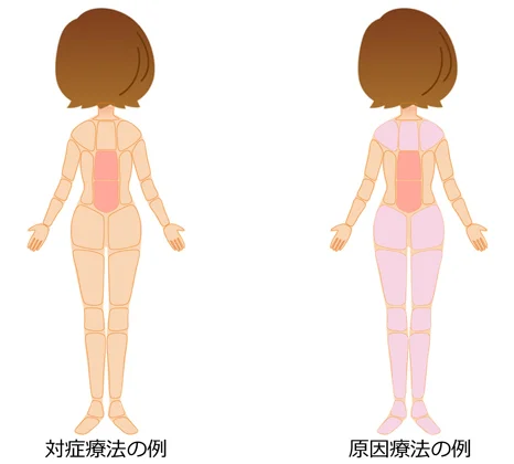 対処療法 原因療法の治療部位