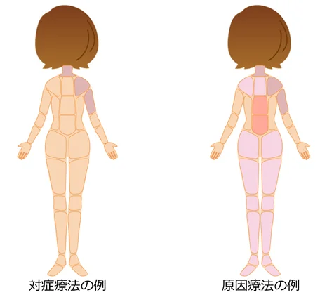 対症療法 原因療法の治療部位