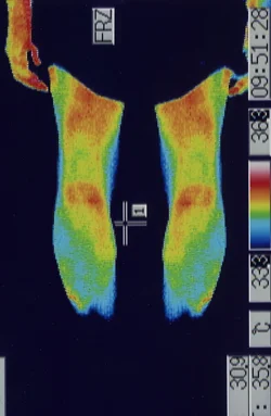 ストレスが改善して温度が上がったふくらはぎのサーモグラフィー