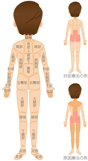 腰痛を治す治療部位