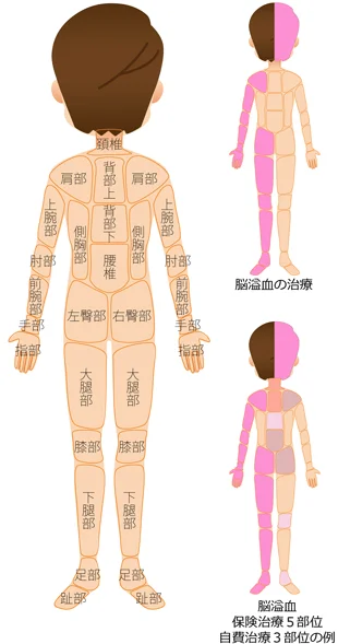 対処療法 原因療法の治療部位