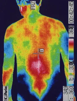 左首と腰に炎症があるサーモ画像
