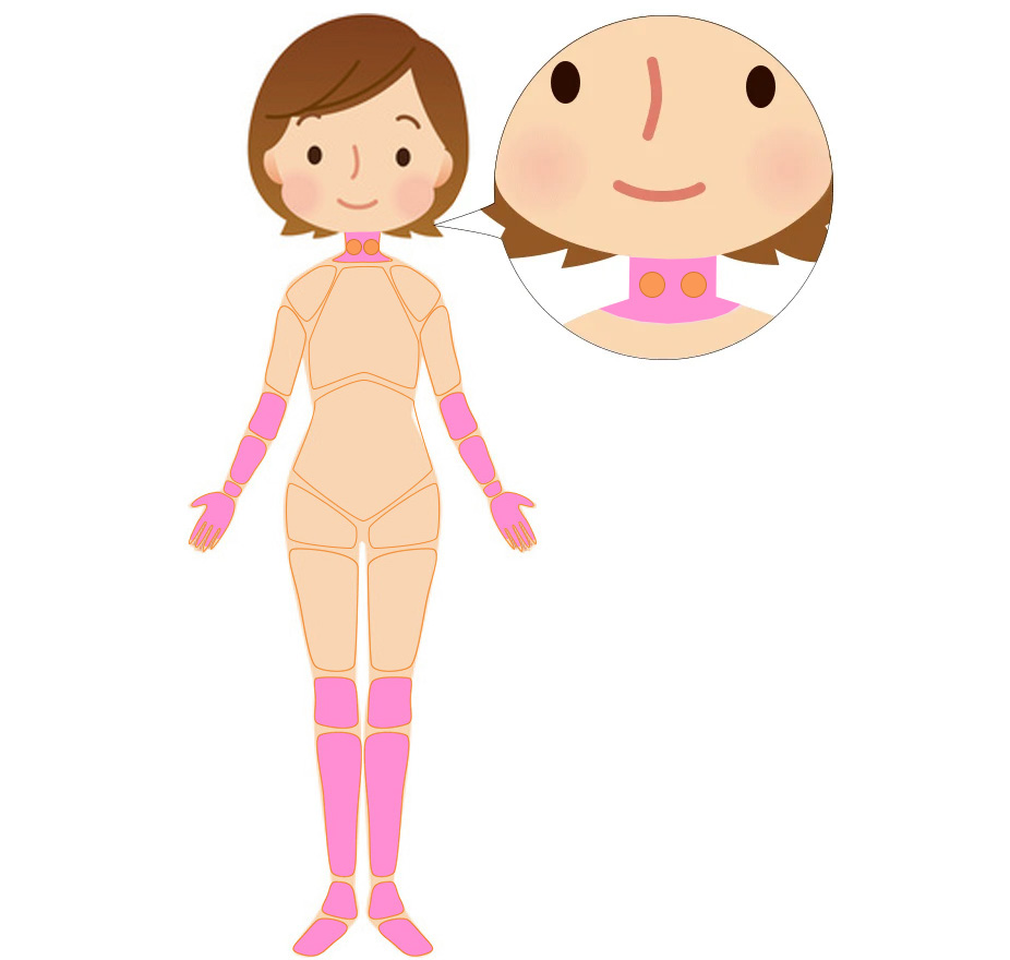 全身性エリテマトーデスの鍼治療Ａ