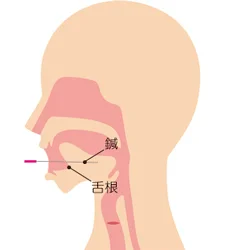 アルツハイマー型認知症の鍼治療